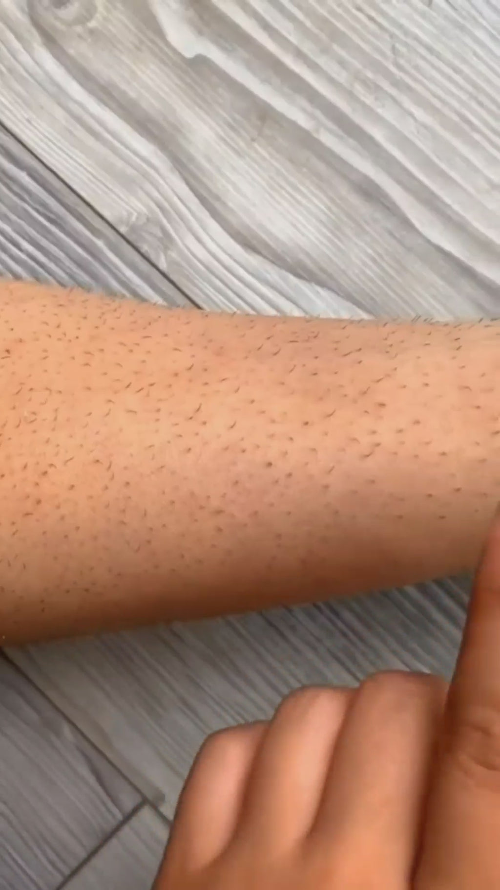 Depilador de Cristal